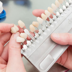 Bild zeigt eine Reihe von Zahnfarben in verschiedenen Weiß- und Gelbtönen Bild zeigt eine Reihe von Zahnfarben in verschiedenen Weiß- und Gelbtönen