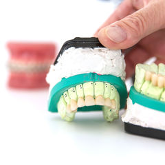 Bild zeigt ein Zahnmodell Bild zeigt ein Zahnmodell