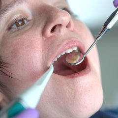 Bild zeigt eine Untersuchung der Zähne einer Patientin